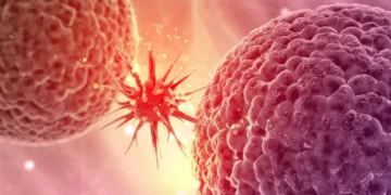 How Surgeon Catches Cancer